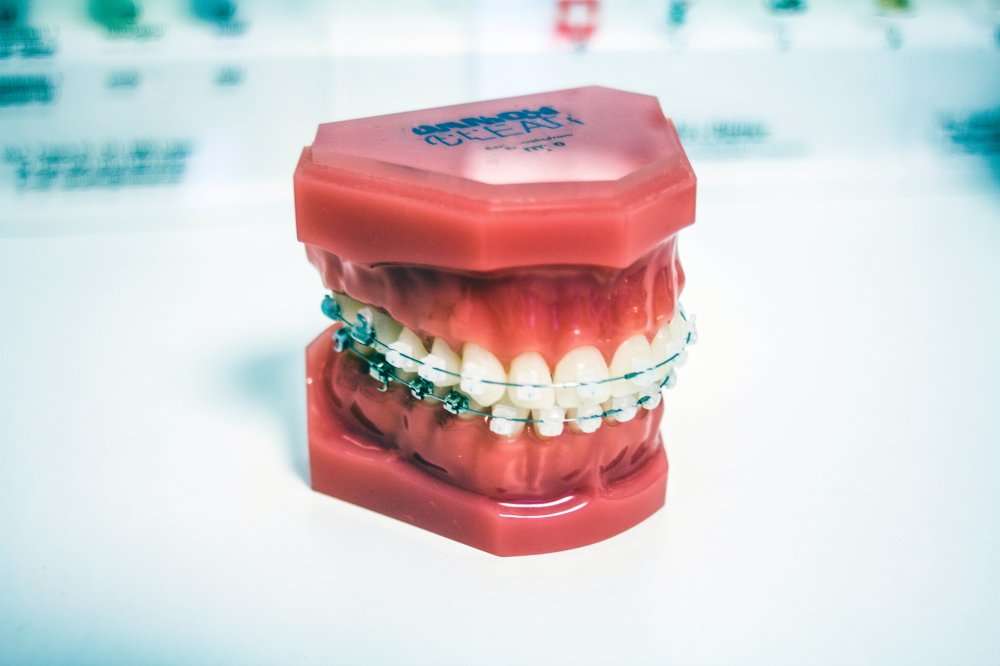 Tveksam inför besöket hos tandläkaren i Kista – bara gör det!