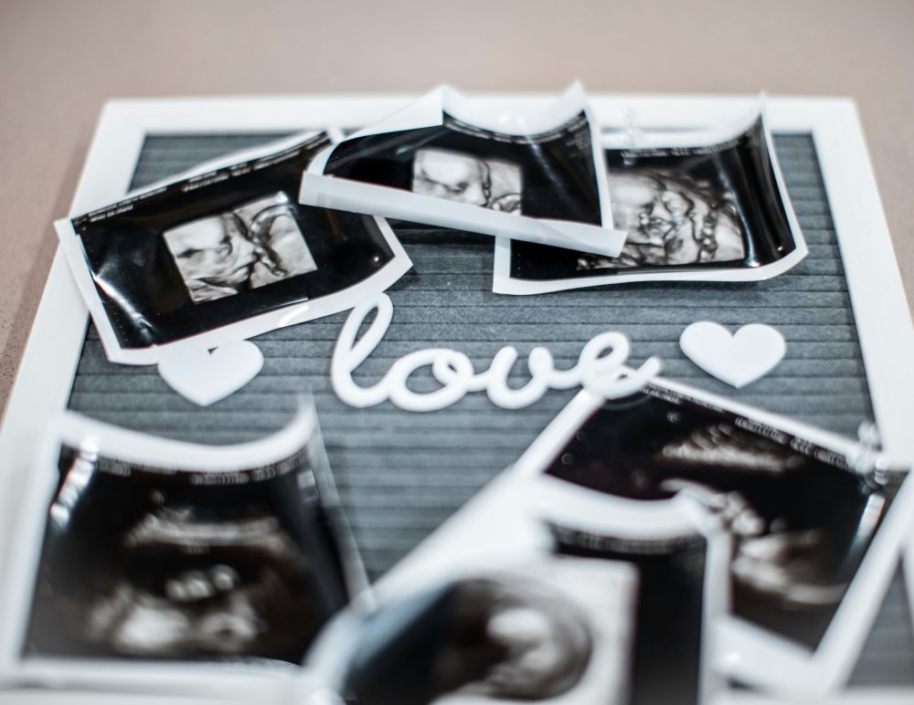 Ultraljud inför ivf  vad händer och varför är det så viktigt?